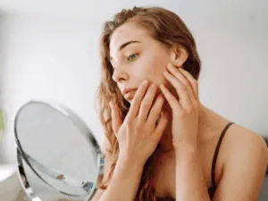 Ragazza che osserva allo specchio i primi brufoli da skin purging sulle guance