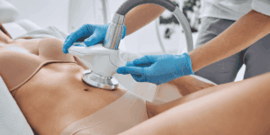 Trattamento di cavitazione estetica sull’addome per ridurre il grasso localizzato con ultrasuoni