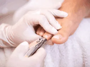 Trattamento di pedicure curativo eseguito da esperta con strumenti professionali su unghie dei piedi.
