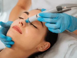 Trattamento HydraFacial con applicazione del manipolo vacuum sulla zona nasale per estrazione delle impurità e idratazione profonda.