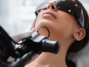 Trattamento laser frazionale CO2 Paziente in trattamento con laser frazionato CO2 su viso, protezione oculare indossata.