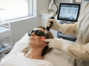 Trattamento laser per ridurre le macchie scure sul viso di una paziente.