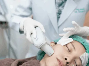 Trattamento HIFU viso per stimolazione profonda del collagene e rassodamento guance.
