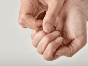 Unghie rovinate e sfaldate con cuticole secche in primo piano