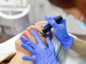 Donna durante trattamento vacuum estetico con manipolo professionale adatto alla micro-aspirazione viso per ridurre impurità e pori ostruiti.