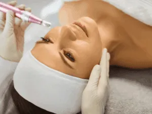 Microneedling estetico viso professionale Trattamento di microneedling estetico sul viso eseguito con dermapen in centro estetico