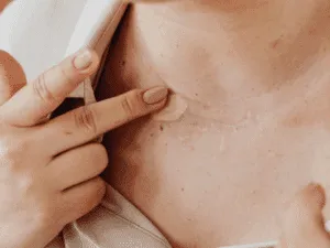 Applicazione di correttore su cicatrice sul collo