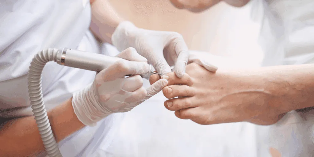 Pedicure curativo professionale eseguito da un’estetista con guanti e fresa su unghie dei piedi.