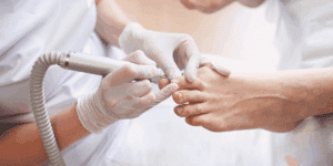 Pedicure curativo professionale eseguito da un’estetista con guanti e fresa su unghie dei piedi.