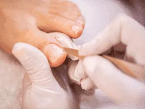 Podologo che effettua un pedicure curativo con strumenti professionali per il trattamento delle unghie dei piedi.