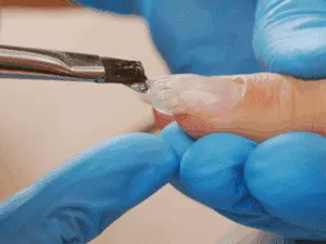prodotto per ricostruzione unghie applicato