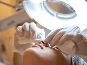 Estrazione professionale dei punti neri in centro estetico Estetista con guanti effettua l’estrazione dei punti neri nella zona del naso durante una pulizia del viso avanzata sotto lampada professionale.
