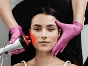 Trattamento professionale di radiofrequenza estetica viso per stimolare il collagene e migliorare la tonicità della pelle