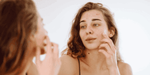 ragazza si guarda allo specchio e nota una reazione di skin purging