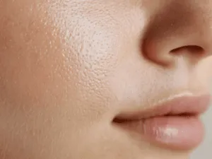 Texture della pelle del viso migliorata dopo trattamento skinbooster