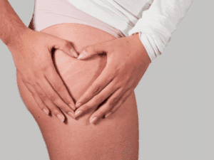 Smagliature bianche sulla coscia evidenziate con le mani a forma di cuore.
