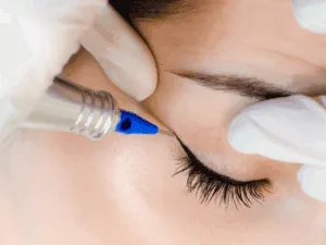 Realizzazione di eyeliner semipermanente sottile con dermografo durante il trattamento.