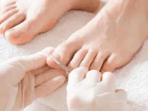 Pedicure curativa con taglio delle unghie dei piedi da parte di un professionista.