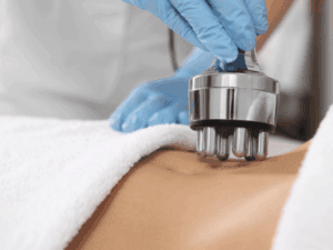 Applicazione della radiofrequenza corpo con gel conduttivo sulla zona addominale