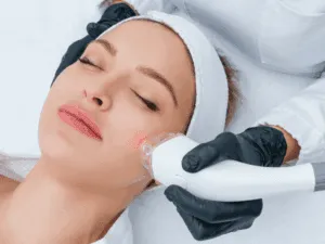 Donna sottoposta a trattamento laser per acne, con applicazione del dispositivo sulla pelle del viso