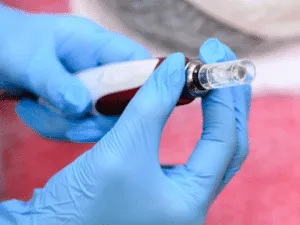 Dispositivo professionale per microdermoabrasione viso con punta di diamante utilizzato nei trattamenti estetici per esfoliare e levigare la pelle.