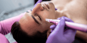 Trattamento di microneedling viso eseguito con dermapen su paziente in centro estetico professionale