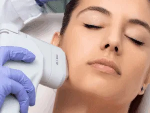 Seduta di lifting viso HIFU senza bisturi per una pelle giovane e tonica.