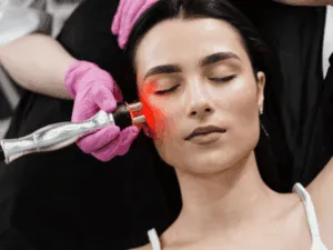 Trattamento viso radiofrequenza per stimolare collagene ed elastina e migliorare il contorno del viso