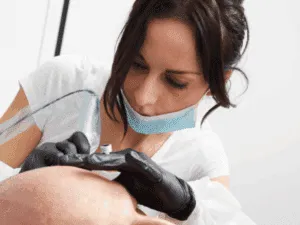 Seduta professionale di tatuaggio capelli tramite tricopigmentazione Professionista mentre effettua una seduta di tatuaggio capelli con dermografo per tricopigmentazione