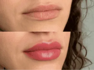 foto del prima e dopo trucco semipermanente labbra