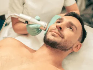 Uomo sottoposto a trattamento vacuum viso professionale con estetista che utilizza dispositivo a micro-aspirazione per purificare la pelle.